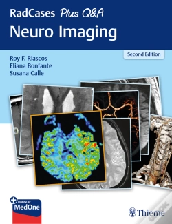 Capa do artigo Radcases Plus Q&A Neuro Imaging