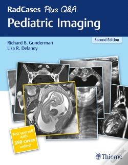 Capa do artigo Radcases Plus Q&A Pediatric Imaging