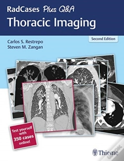 Capa do artigo Radcases Plus Q&A Thoracic Imaging