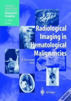 Capa do artigo Radiological Imaging In Hematological Malignancies