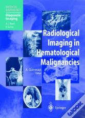 Radiological Imaging In Hematological Malignancies