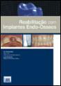 Reabilitação com Implantes Endo-Ósseos - Preview