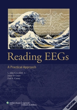Capa do artigo Reading Eegs: A Practical Approach
