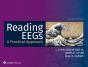 Reading Eegs: A Practical Approach - Preview