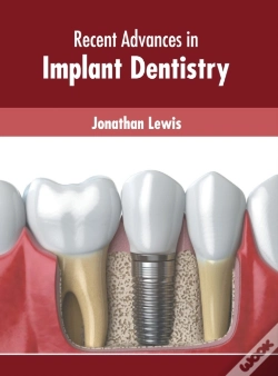 Capa do artigo Recent Advances In Implant Dentistry
