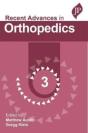 Recent Advances In Orthopedics - 3 - Preview