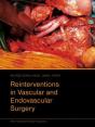 Reinterventions In Vascular And Endovascular Surgery - Preview