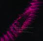 Rememberance (The Remixes) - Vinil - Preview
