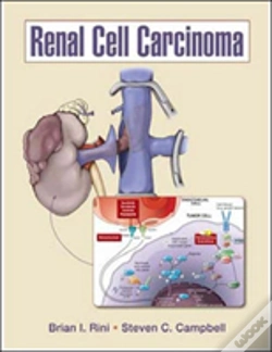 Capa do artigo Renal Cell Carcinoma