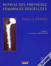 Reprise Des Prothèses Fémorales Descellées