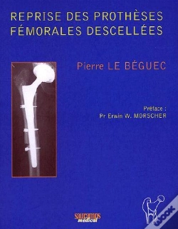 Capa do artigo Reprise Des Prothèses Fémorales Descellées