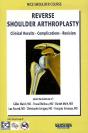 Reserve Shoulder Arthroplasty ; Clinical Results, Complications, Revision - Preview