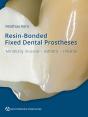 Resin-Bonded Fixed Dental Prostheses - Preview