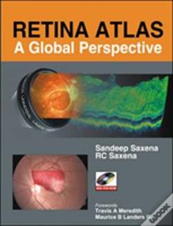 Capa do artigo Retina Atlas