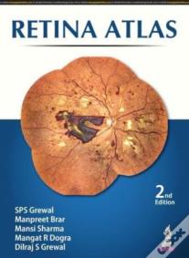Retina Atlas