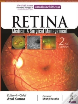 Capa do artigo Retina