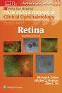 Retina - Preview