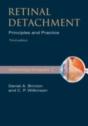 Retinal Detachment - Preview