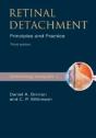 Retinal Detachment - Preview