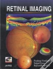 Retinal Imaging