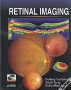 Capa do artigo Retinal Imaging