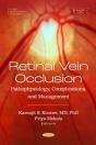 Retinal Vein Occlusion: Pathophysiology, Complications, And Management - Preview