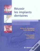 Réussir Les Implants Dentaires