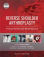 Reverse Shoulder Arthroplasty - Preview