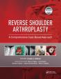 Reverse Shoulder Arthroplasty - Preview