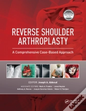 Capa do artigo Reverse Shoulder Arthroplasty
