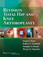 Revision Total Hip And Knee Arthroplasty - Preview