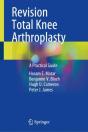 Revision Total Knee Arthroplasty - Preview
