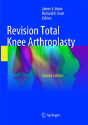 Revision Total Knee Arthroplasty - Preview