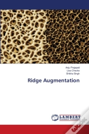 Capa do artigo Ridge Augmentation
