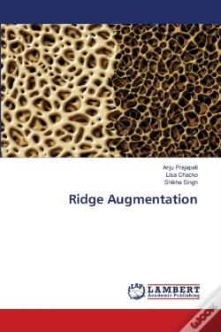 Capa do artigo Ridge Augmentation