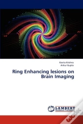 Ring Enhancing Lesions On Brain Imaging