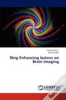 Ring Enhancing Lesions On Brain Imaging