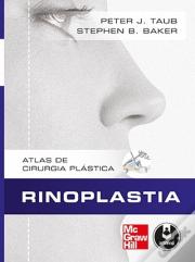 Rinoplastia
