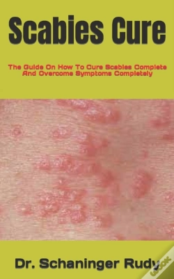 Capa do artigo Scabies Cure