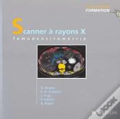 Capa do artigo Scanner A Rayon X ; Tomodensitometrie