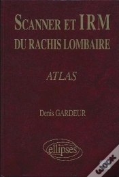 Capa do artigo Scanner Irm Rachis Lomb.Atlas