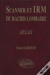 Scanner Irm Rachis Lomb.Atlas