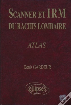 Capa do artigo Scanner Irm Rachis Lomb.Atlas