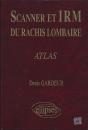 Scanner Irm Rachis Lomb.Atlas - Preview