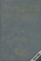 Capa do artigo Scanner Irm Rachis Lomb.Texte