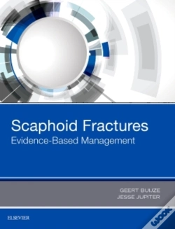 Capa do artigo Scaphoid Fractures: Evidence-Based Management