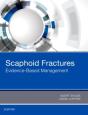 Scaphoid Fractures: Evidence-Based Management - Preview