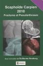 Scaphoïde Carpien ; Fractures Et Pseudoarthroses (Édition 2010) - Preview
