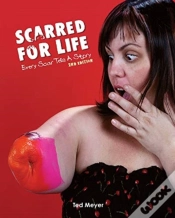 Capa do artigo Scarred For Life. 2nd Edition