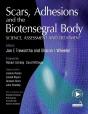 Scars, Adhesions And The Biotensegral Body - Preview